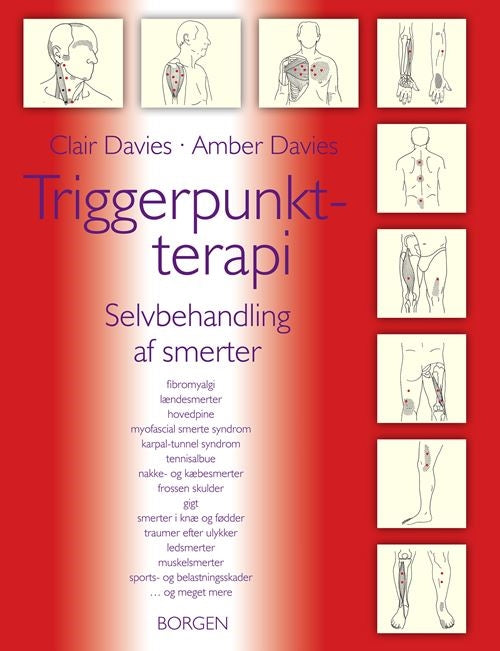 TRIGGERPUNKT-TERAPI