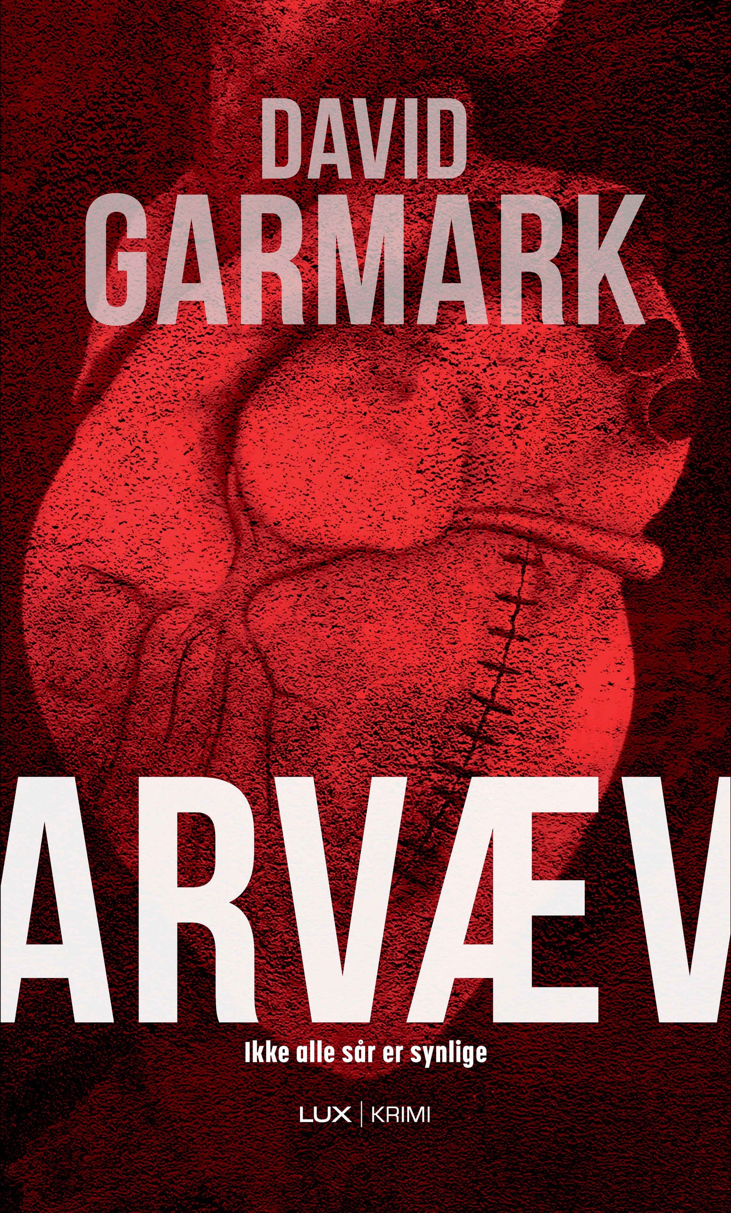 ARVÆV