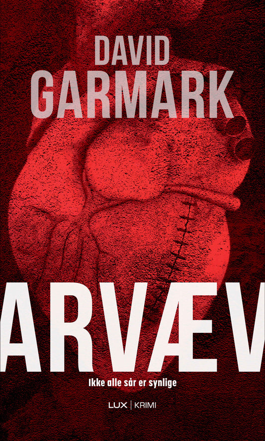 ARVÆV
