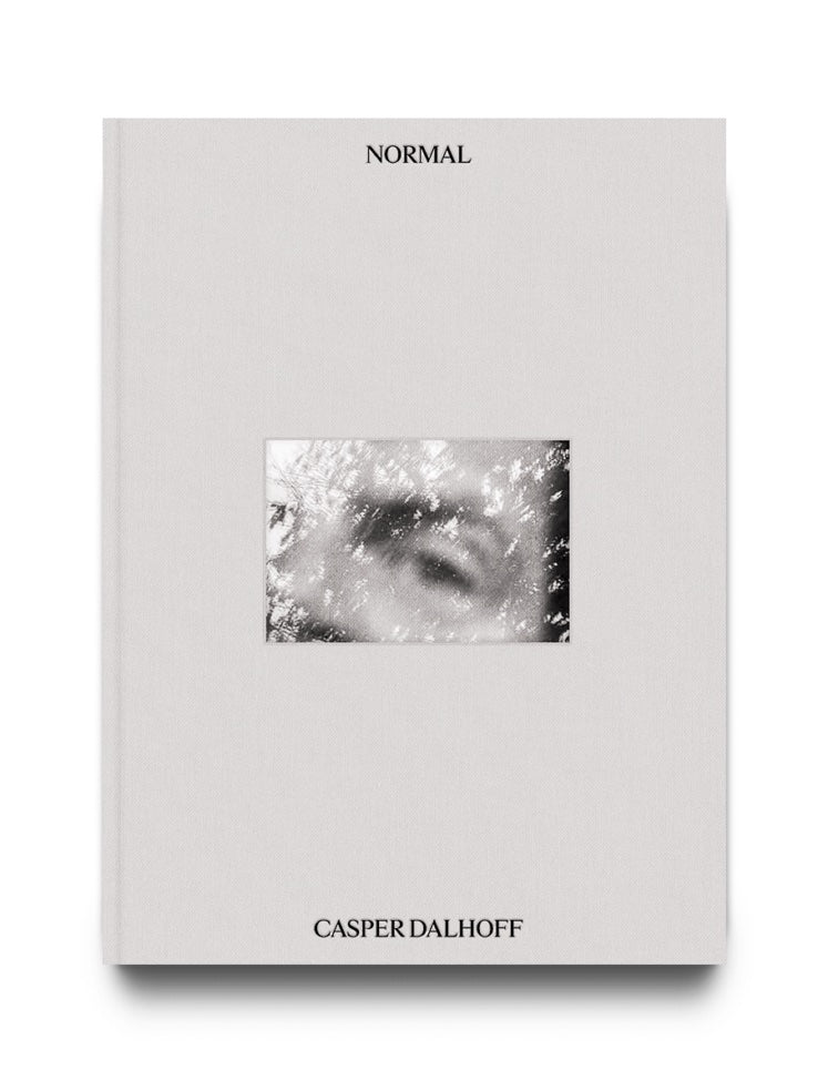 NORMAL