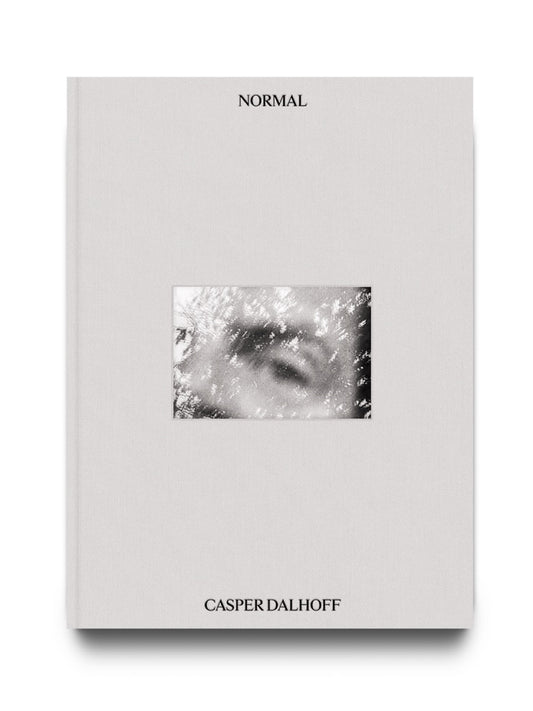 NORMAL